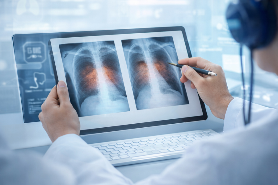 Pnömokonyoz Değerlendirmesi